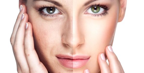  Rejuvenecimiento Facial